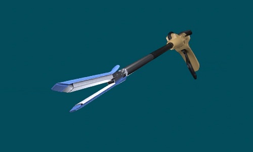 Aplicações clínicas do reforço da linha de grampo SIS