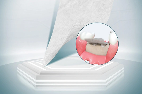 Materiais cirúrgicos dentais