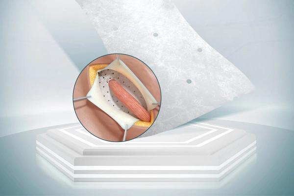 Produtos biológicos SIS para cirurgia geral