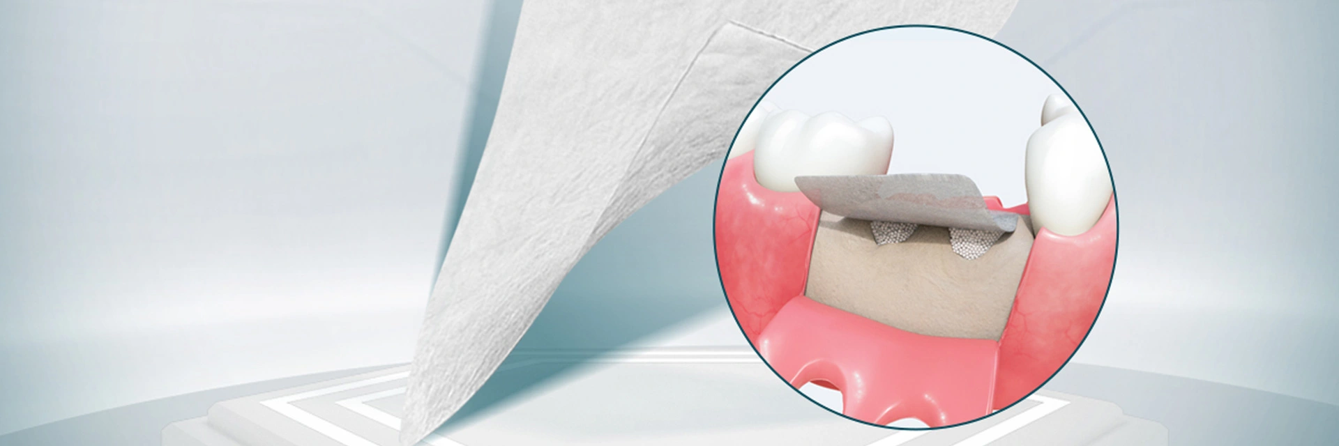 Materiais cirúrgicos dentais