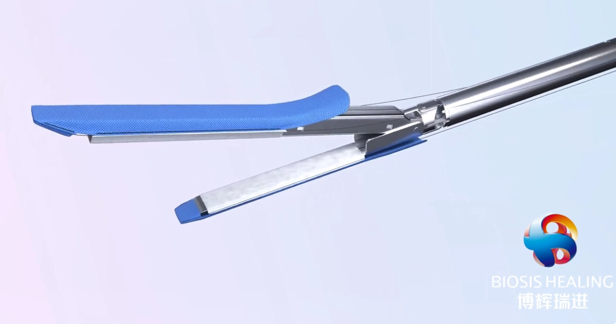 Linha de grampo reforço para manga gastrectomia para cirurgia bariátrica