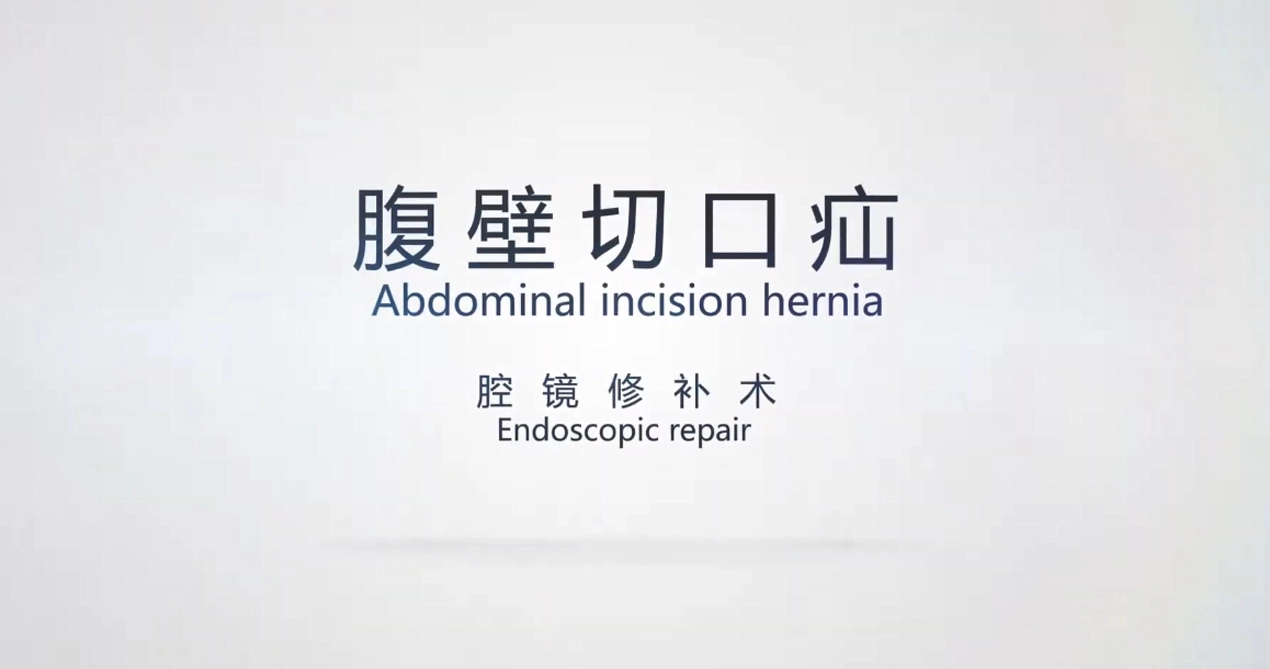 Incisão abdominal Reparação de hérnia