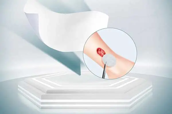 Produtos de Gestão de Feridas