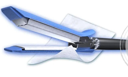 Interpretação do consenso | Consenso de especialistas em estratégias de manejo para vazamento de ar pulmonar persistente durante a cirurgia torácica perioperatória e os benefícios clínicos da matriz extracelular do intestino delgado porcino não reticulado (SIS) mater