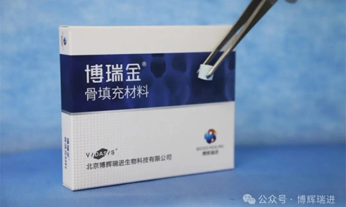 Os produtos Vidasis Bone Graft Material obtiveram oficialmente a certificação, e a família oral Biosis Healing deu as boas-vindas a outro
